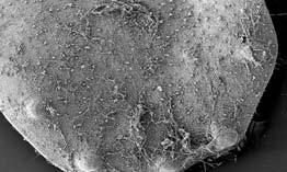 Oval projections of the posterior border of one elytron (SEM)